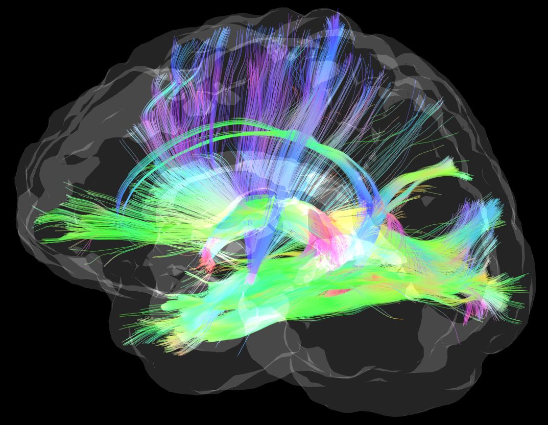 Reconstruction colorée des faisceaux de fibres nerveuses d'un cerveau humain.